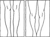 Управление телом по методу Пилатеса - any2fbimgloader12.jpeg