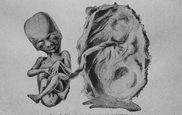 Этюды о природе человека - i_011.jpg