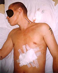 Статьи о ножах и не только - articles_after_knife_fight_2