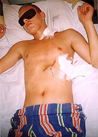 Статьи - articles_after_knife_fight_3