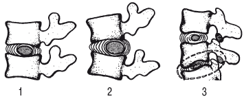 Позвоночник и суставы. Лечение и профилактика - i_024.png