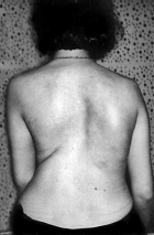 Позвоночник и суставы. Лечение и профилактика - i_076.png