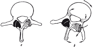 Позвоночник и суставы. Лечение и профилактика - i_077.png