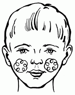 Логопедический массаж при дизартрии - i_143.png