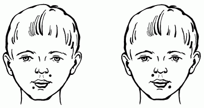 Логопедический массаж при дизартрии - i_147.png