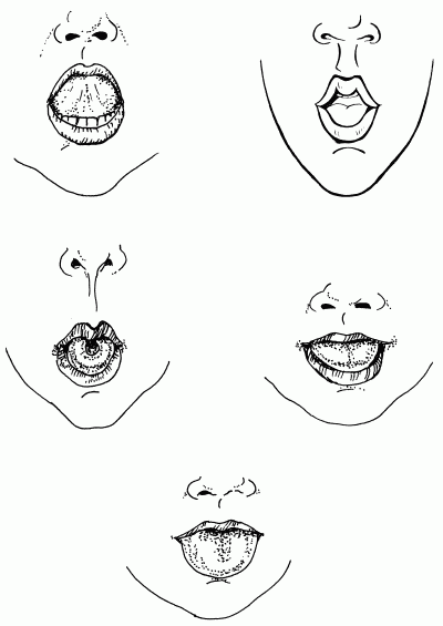 Логопедический массаж при дизартрии - i_151.png