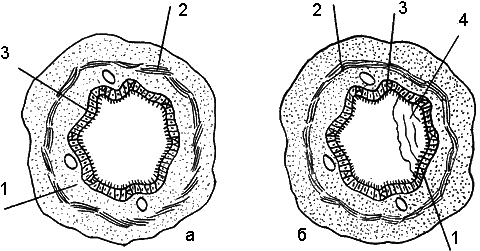 Массаж при бронхиальной астме - _002.png