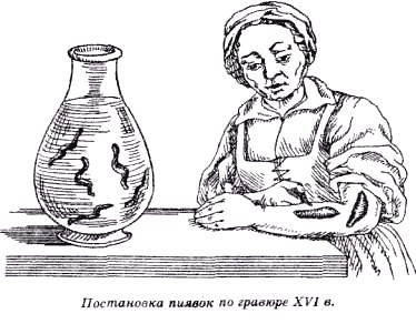 Секреты гирудотерапии - i_019.jpg