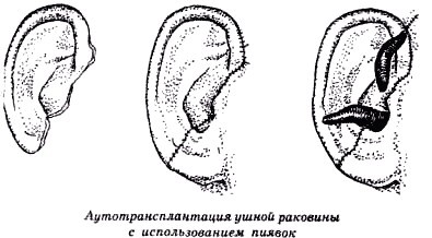 Секреты гирудотерапии - i_023.jpg