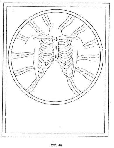 Релаксация Кум нье - image37.jpg