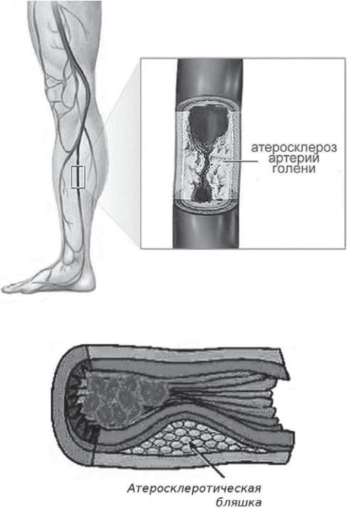 Сыроедение против предрассудков. Эволюция в питании человека - img3830.jpg
