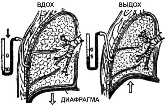 Лечение перекисью водорода - i_002.jpg