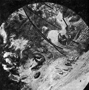 Лисица - img_8.png