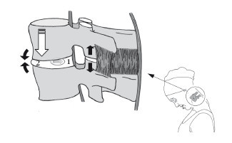Диагностика и лечение позвоночника. Уникальная система доктора А. М. Уриа - i_038.jpg