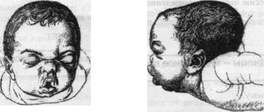 Остеопатия для малышей - image003.jpg