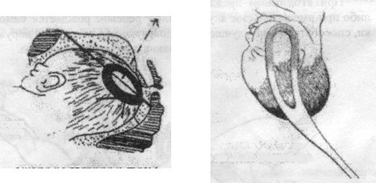 Остеопатия для малышей - image005.jpg