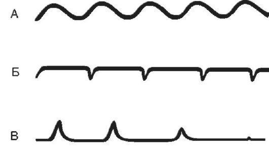 Патофизиология. Том 2 - _61.jpg