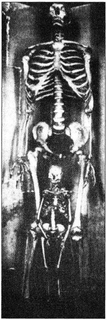 Катастрофы тела - i_026.jpg