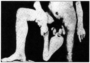 Катастрофы тела - i_110.jpg