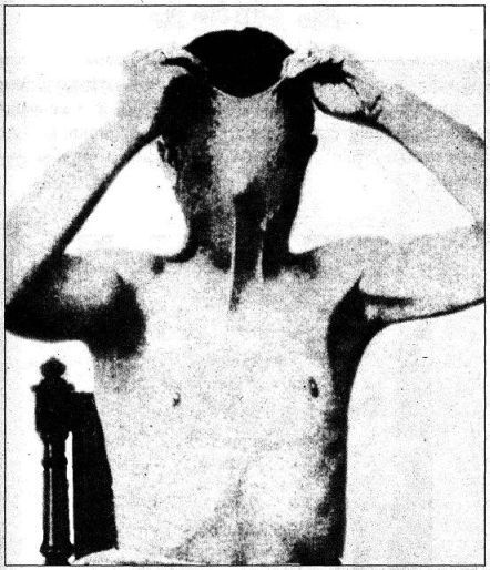 Катастрофы тела - i_172.jpg