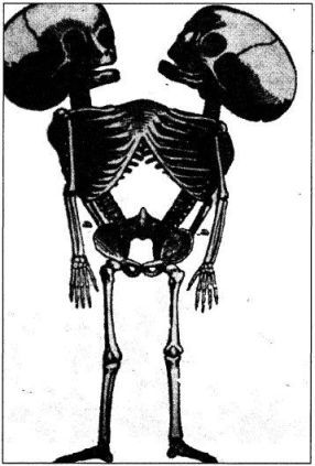 Катастрофы тела - i_203.jpg