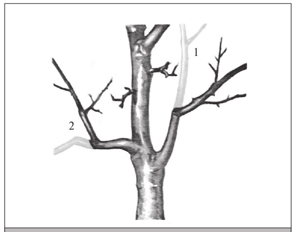 Формирование и обрезка садовых деревьев - i_059.jpg