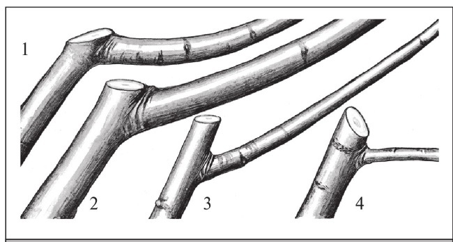 Формирование и обрезка садовых деревьев - i_061.jpg