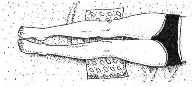 Плоскостопие у детей - doc2fb_image_02000009.jpg