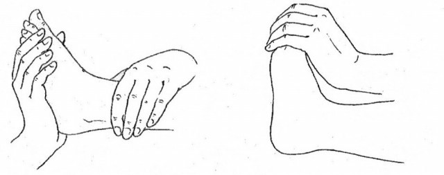 Плоскостопие у детей - doc2fb_image_0200000A.jpg