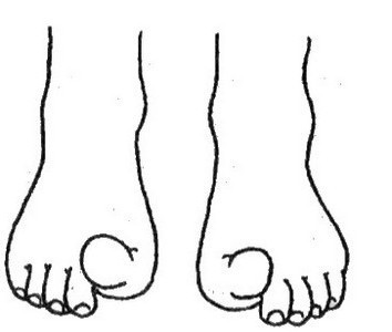 Плоскостопие у детей - doc2fb_image_0200000C.jpg