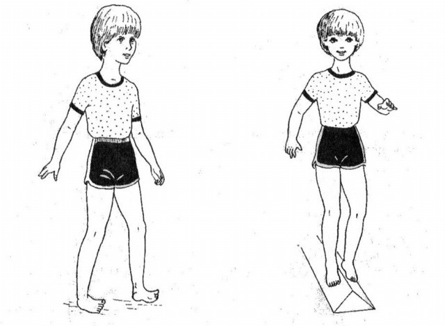 Плоскостопие у детей - doc2fb_image_02000033.jpg