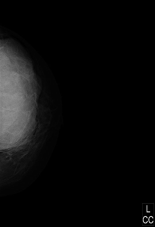 Мастопатия и гинекомастия - ris16.jpg