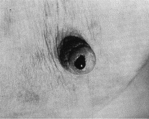 Мастопатия и гинекомастия - ris221.jpg