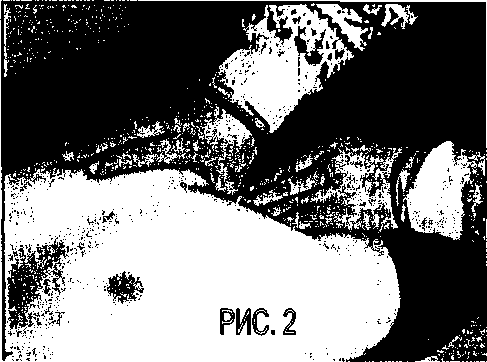 Желчный пузырь. С ним и без него - i_002.png
