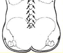 Массаж при хронической венозной недостаточности нижних конечностей - _44.jpg