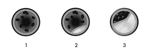 Глина лечит. Артрит и артроз, остеохондроз, ушибы и ожоги, волосы и кожу - i_004.jpg