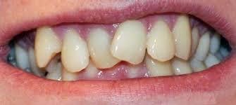 Забыть стоматологов. Диеты. Симперцептинг - _2.jpg