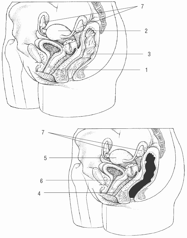 Эффективное лечение и профилактика желудочно-кишечных заболеваний - i_007.png