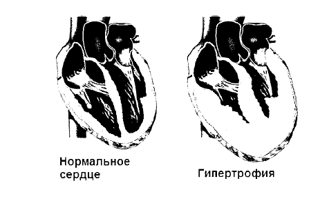 Лечение болезней нервной системы биологически активными добавками к пище (БАД) - i_010.png