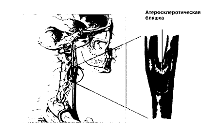 Лечение болезней нервной системы биологически активными добавками к пище (БАД) - i_013.png