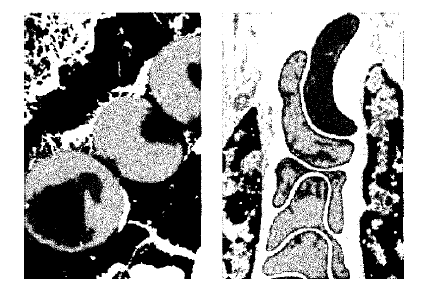Лечение болезней нервной системы биологически активными добавками к пище (БАД) - i_014.png