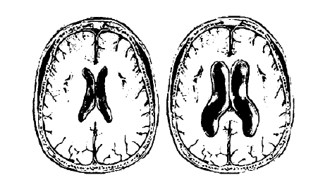 Лечение болезней нервной системы биологически активными добавками к пище (БАД) - i_015.png