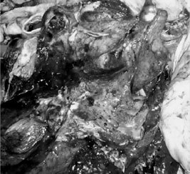 ХОБЛ. Руководство для практических врачей - i_004.jpg