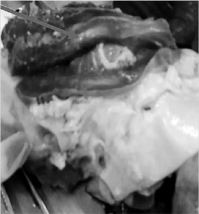 ХОБЛ. Руководство для практических врачей - i_007.jpg