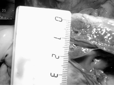 ХОБЛ. Руководство для практических врачей - i_008.jpg