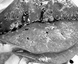 ХОБЛ. Руководство для практических врачей - i_011.jpg