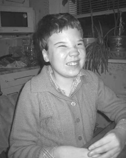 Дети с синдромом Ретта - _69.jpg