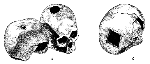 Популярная история медицины - pic_8.png