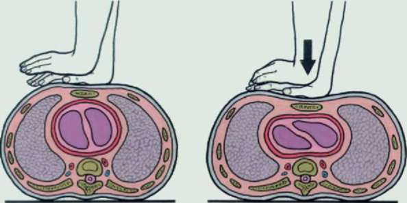 Методичка по оказанию первой помощи - Any2FbImgLoader10
