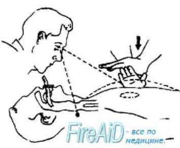 Методичка по оказанию первой помощи - Any2FbImgLoader11